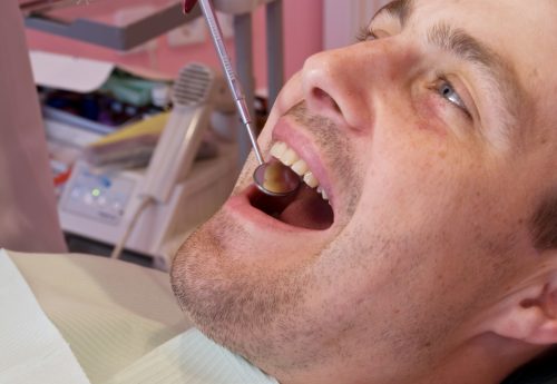 Jak zastąpić utracony ząb?